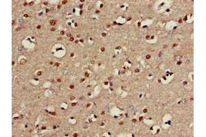 Immunohistochemistry of paraffin-embedded human brain tissue using ABIN7146672 at dilution of 1:100 (CHST1 抗体  (AA 305-397))
