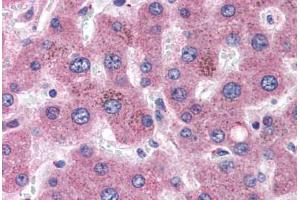 Human Liver (formalin-fixed, paraffin-embedded) stained with APOC1 antibody ABIN351488 at 3. (APOC1 抗体  (AA 70-83))