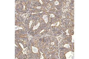 IHC analysis of TST using anti-TST antibody (ABIN7599105). (TST 抗体  (AA 1-220))
