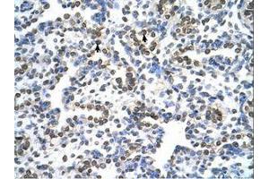 Image no. 1 for anti-Mitochondrial Ribosomal Protein S15 (MRPS15) (AA 51-100) antibody (ABIN6737717) (MRPS15 抗体  (AA 51-100))