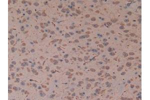 Immunohistochemistry (IHC) image for anti-Tumor Protein P53 (TP53) (AA 134-387) antibody (ABIN7429403)