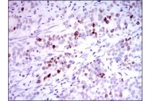 Image no. 7 for anti-Inner Centromere Protein Antigens 135/155kDa (INCENP) antibody (ABIN1491465)