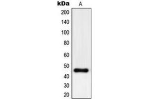 Western blot analysis of PHKG1 expression in A375 (A) whole cell lysates. (PHKG1 抗体  (Center))