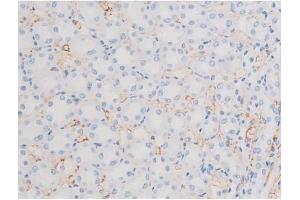 ABIN6256390 and ABIN6267486 at 1/200 staining Rat kidney tissue sections by IHC-P. (IRS1 抗体  (pSer639))
