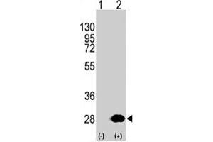 Western blot analysis of HSPB1 (arrow) using HSPB1 polyclonal antibody . (HSP27 抗体  (Ser82))