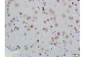 Immunohistochemistry (IHC) image for anti-Inhibitor of DNA Binding 1, Dominant Negative Helix-Loop-Helix Protein (ID1) (AA 51-155) antibody (ABIN700330)