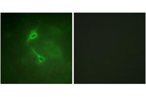 Immunofluorescence analysis of NIH-3T3 cells, using PKC zeta (Ab-560) Antibody. (PKC zeta 抗体  (AA 526-575))