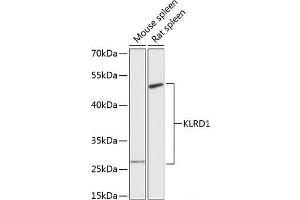 Western blot analysis of extracts of various cell lines using KLRD1 Polyclonal Antibody at dilution of 1:3000. (CD94 抗体)