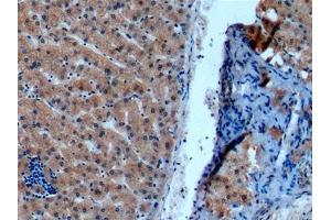 Detection of NOS2 in Human Liver Tissue using Monoclonal Antibody to Nitric Oxide Synthase 2, Inducible (NOS2) (NOS2 抗体  (AA 734-966))