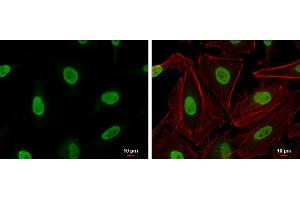 ICC/IF Image Ku70 antibody detects Ku70 protein at nucleus by immunofluorescent analysis.