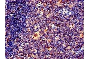 Immunohistochemistry of paraffin-embedded human tonsil tissue using ABIN7151428 at dilution of 1:100 (EFHD2 抗体  (AA 2-240))