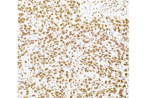 Immunohistochemistry (IHC) image for anti-RNA-binding protein Raly (RALY) (AA 256-306) antibody (ABIN7454547)