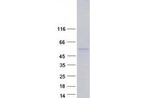 Western Blotting (WB) image for phosphodiesterase 9A (PDE9A) (Transcript Variant 9) protein (Myc-DYKDDDDK Tag) (ABIN2728530)