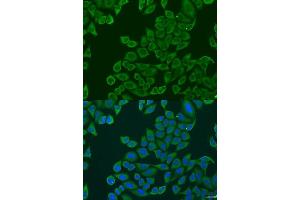 Immunofluorescence analysis of U2OS cells using RPL36 antibody. (RPL36 抗体  (AA 1-105))