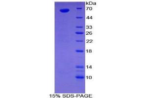 SDS-PAGE analysis of Human Sulfatase 1 Protein. (SULF1 蛋白)
