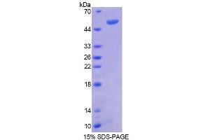 SDS-PAGE (SDS) image for Regulator of G-Protein Signaling 1 (RGS1) (AA 1-209) protein (His tag,GST tag) (ABIN6237852)