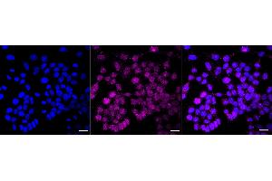 anti-MAD2 Mitotic Arrest Deficient-Like 1 (Yeast) (MAD2L1) antibody