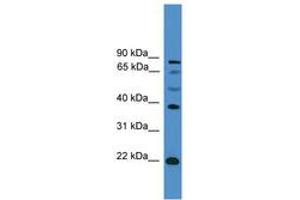 Image no. 1 for anti-Achaete-Scute Complex Homolog 2 (ASCL2) (AA 121-170) antibody (ABIN6745359) (ASCL2 抗体  (AA 121-170))