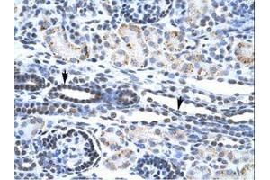 Image no. 2 for anti-V-Ets erythroblastosis Virus E26 Oncogene Homolog 1 (Avian) (ETS1) (AA 52-101) antibody (ABIN202532) (ETS1 抗体  (AA 52-101))