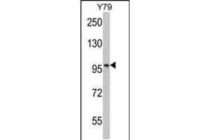 Western blot analysis of KPNB1 Antibody in Y79 cell line lysates (35ug/lane) (KPNB1 抗体  (N-Term))