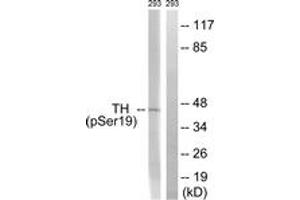 Western blot analysis of extracts from 293 cells treated with Insulin 0. (Tyrosine Hydroxylase 抗体  (pSer18))