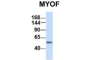 Western Blotting (WB) image for anti-Myoferlin (MYOF) (C-Term) antibody (ABIN2782797)