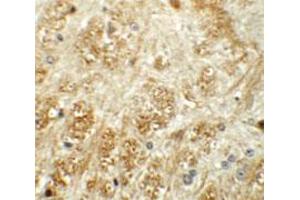 Immunohistochemical staining of mouse brain cells with ATP2C1 polyclonal antibody  at 5 ug/mL. (ATP2C1 抗体  (C-Term))
