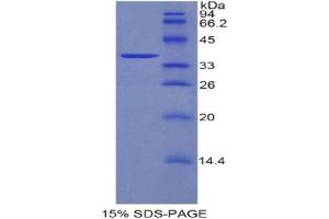 SDS-PAGE analysis of Mouse DKK4 Protein. (DKK4 蛋白)
