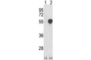 Western blot analysis of PHGDH antibody and 293 cell lysate either nontransfected (Lane 1) or transiently transfected with the PHGDH gene (2). (PHGDH 抗体  (AA 140-168))