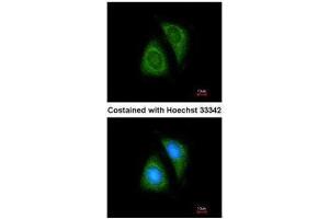 ICC/IF Image Immunofluorescence analysis of methanol-fixed HeLa, using SHP1, antibody at 1:200 dilution. (SHP1 抗体  (Center))