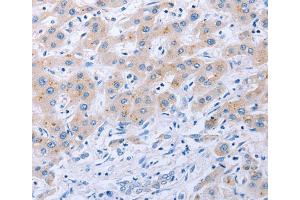Immunohistochemistry (IHC) image for anti-Fibroblast Growth Factor 4 (FGF4) antibody (ABIN2825910) (FGF4 抗体)