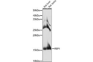 Western blot analysis of extracts of various cell lines, using RBP1 antibody (ABIN6129597, ABIN6146795, ABIN6146796 and ABIN6214136) at 1:1000 dilution. (RBP1 抗体  (AA 63-197))