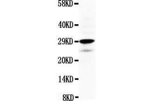 Anti-Calretinin antibody, Western blotting WB: HELA Cell Lysate (Calretinin 抗体  (N-Term))