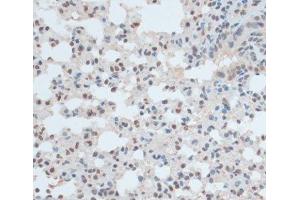 Immunohistochemistry (Paraffin-embedded Sections) (IHC (p)) image for anti-Zinc Finger Protein 433 (ZNF433) antibody (ABIN7258240)