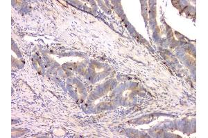 IHC analysis of Cystatin C/CST3 using anti-Cystatin C/CST3 antibody (ABIN6719299). (CST3 抗体  (AA 31-146))