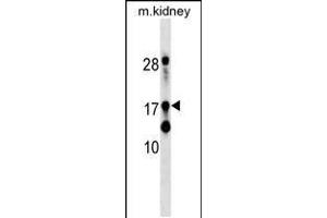 Western blot analysis in mouse kidney tissue lysates (35ug/lane). (DR1 抗体  (AA 83-112))