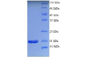 SDS-PAGE (SDS) image for Neurotrophin 4 (NTF4) (AA 82-210) protein (His tag) (ABIN5712712)