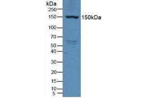 Detection of VEGFR2 in Rat Serum using Polyclonal Antibody to Vascular Endothelial Growth Factor Receptor 2 (VEGFR2) (VEGFR2/CD309 抗体  (AA 46-320))