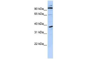 PHF11 antibody used at 0. (PHF11 抗体  (N-Term))