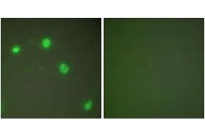 Immunofluorescence analysis of COS7 cells, using Ku70 Antibody. (XRCC6 抗体  (AA 560-609))