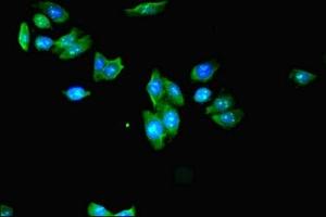 Immunofluorescent analysis of HepG2 cells using ABIN7157306 at dilution of 1:100 and Alexa Fluor 488-congugated AffiniPure Goat Anti-Rabbit IgG(H+L) (KLHDC5 抗体  (AA 1-410))