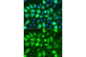 Immunofluorescence analysis of A549 cells using RRM2 antibody. (RRM2 抗体  (AA 1-389))