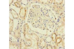 Immunohistochemistry of paraffin-embedded human kidney tissue using ABIN7171203 at dilution of 1:100