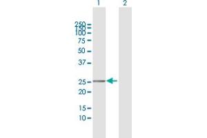 Western Blot analysis of TMEM177 expression in transfected 293T cell line by TMEM177 MaxPab polyclonal antibody. (TMEM177 抗体  (AA 31-311))