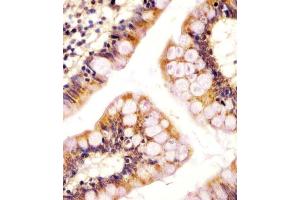 (ABIN655484 and ABIN2845005) staining RSBN1 in human colon tissue sections by Immunohistochemistry (IHC-P - paraformaldehyde-fixed, paraffin-embedded sections). (RSBN1 抗体  (N-Term))