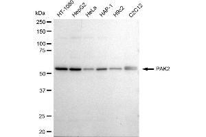 anti-P21-Activated Kinase 2 (PAK2) antibody
