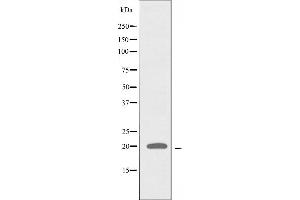 Western blot analysis of extracts from A549 cells, using ATP5L2 antibody. (ATP5L2 抗体  (C-Term))