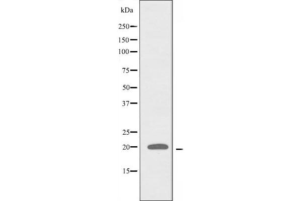 ATP5L2 anticorps  (C-Term)