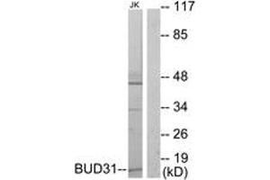 Western blot analysis of extracts from Jurkat cells, using BUD31 Antibody.
