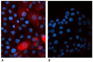 Confocal microscopy of human β2-microglobulin-transfected canine cells labeled A) with B2M-01 antibody Alexa Fluor® 647 conjugate  and B) with Alexa Fluor® 647 conjugated Mouse IgG2a Isotype Control (A6-458-C100). (beta-2 Microglobulin 抗体)